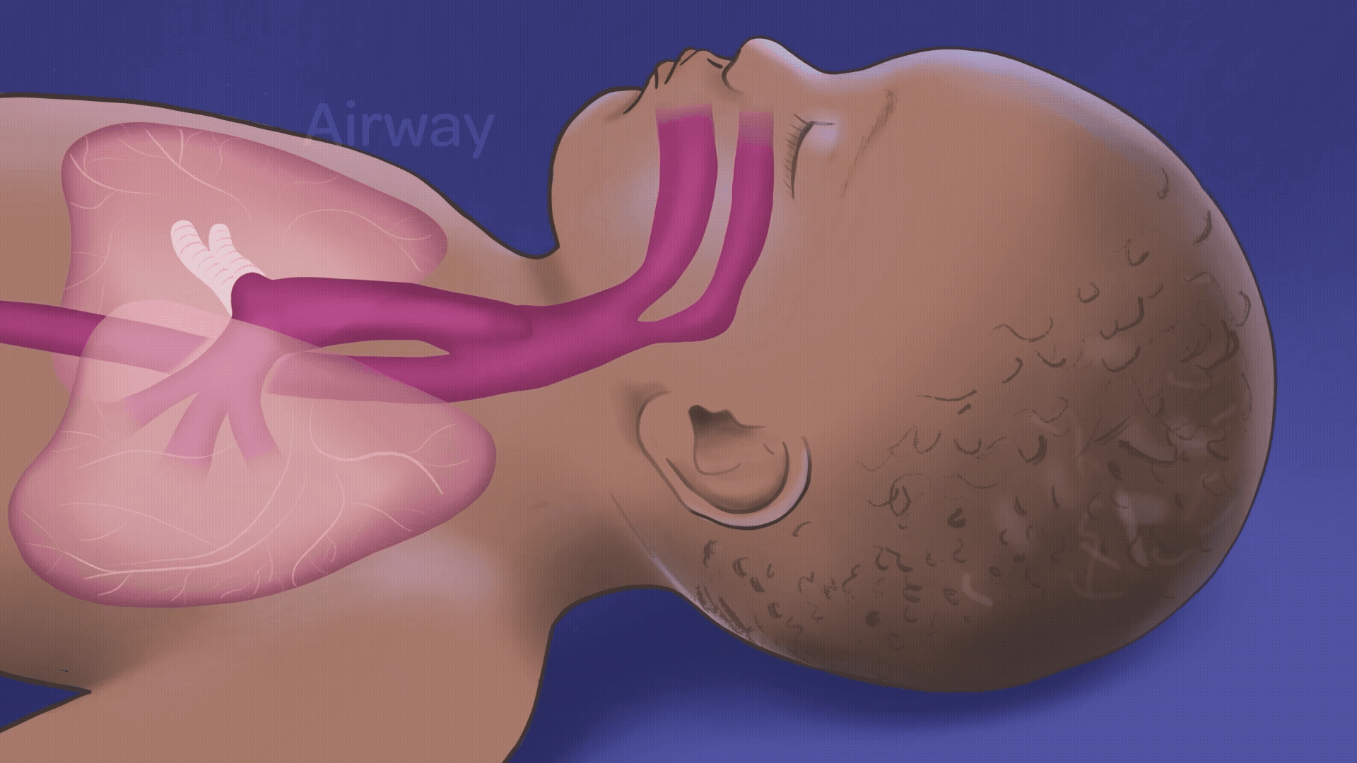 An illustrated medical-style diagram of a baby sleeping on their back against a blue background, with a transparent overlay showing the airway, lungs, and breathing passages. The image highlights an open and unobstructed airway to demonstrate safe infant sleep positioning and respiratory health.